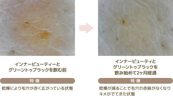 50代女性 乾燥肌タイプ